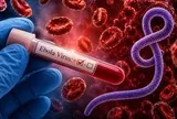 Bác sĩ cảnh báo triệu chứng của Ebola dễ bị bỏ qua