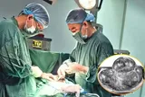 Bụng phình to bất thường, sự thật bác sĩ nói ra khiến người phụ nữ sốc nặng