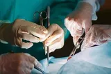 Người đàn ông cắt bỏ dạ dày trị ung thư, mổ xong mới biết mình không mắc bệnh
