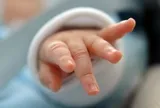 Bé 33 ngày tuổi lờ đờ, thiếu máu nặng sau khi được hàng xóm dùng kim khâu chữa bệnh