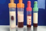 Bé gái 12 tuổi máu "trắng đục như sữa" vì thường xuyên ăn món quen thuộc "vạn người mê"