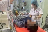 Nhặt con cá trên bờ biển nướng ăn, người đàn ông 38 tuổi hôn mê, tím tái