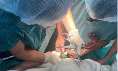 Bé trai 5 tuổi "ôm" ổ khóa nhập viện cấp cứu, bác sĩ phát cảnh báo khẩn