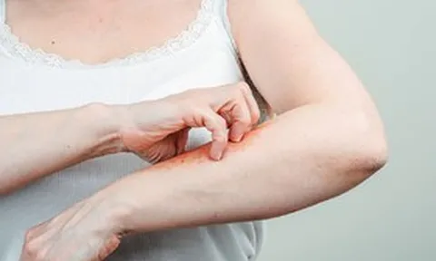 Luôn cảm thấy ngứa, người phụ nữ 59 tuổi "sốc" khi biết mình mắc liền 2 căn bệnh nguy hiểm này