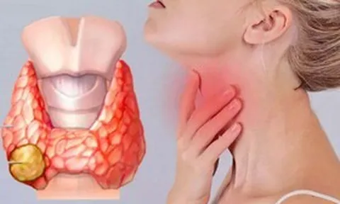 Có những biểu hiện này, đừng chủ quan vì có thể là dấu hiệu ung thư